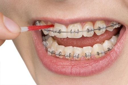 Best Orthodontics Karachi