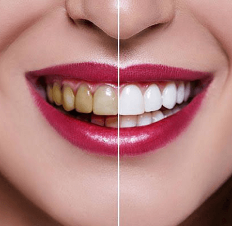 Best Dental Treatment at Altamash Clinic