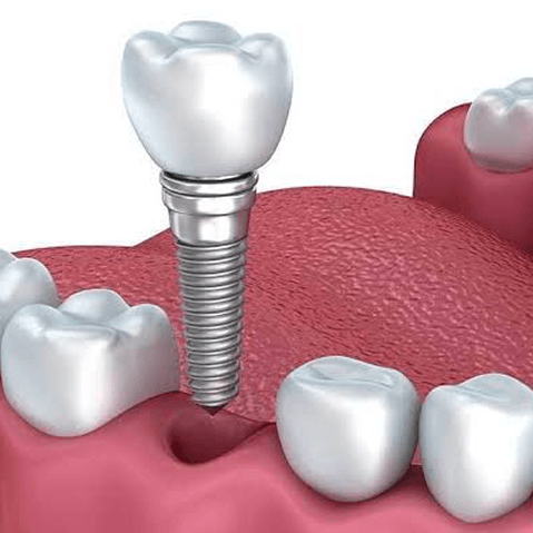 Orthodontics Treatment at Altamash Clinic