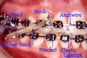 Braces and orthodontic clinic