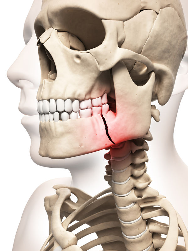 Jaw | Altamash Clinic