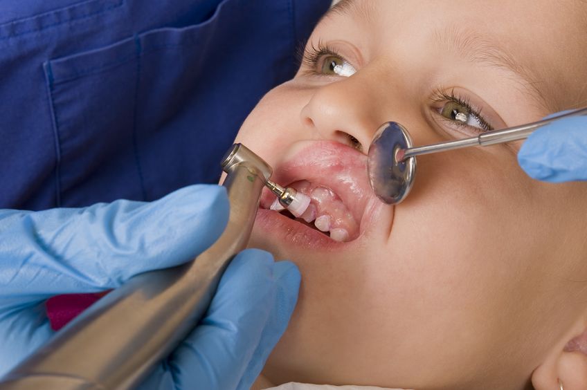 Root Planing for Gum Disease