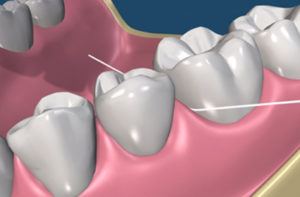 How to floss teeth properly