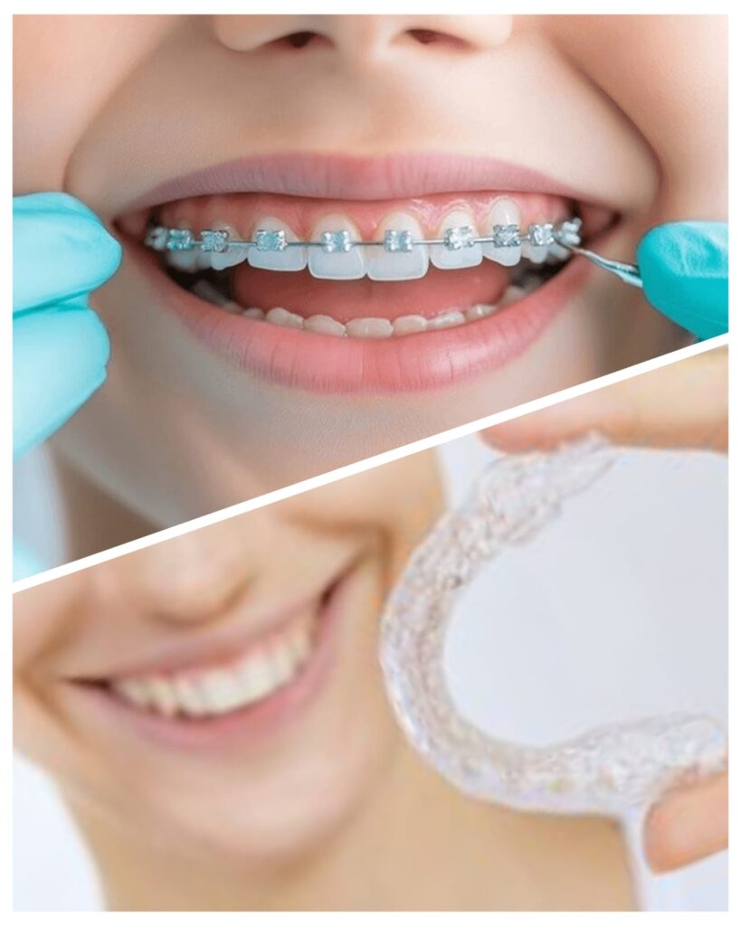 Dental Clinics For Braces in Karachi | Altamash Dental Clinic